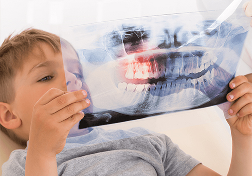 dental x-ray for kids
